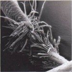 trichorrhexis_nodosa_full